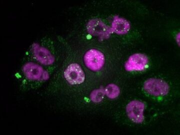 Lo que trae la investigación en el cáncer más letal: desde una ‘app’ para estimar riesgo personalizado, a fármacos más eficaces