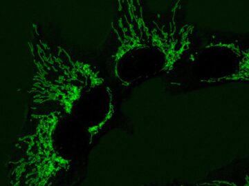 Nature Metabolism: A yeast enzyme helps human cells overcome mitochondrial defects[