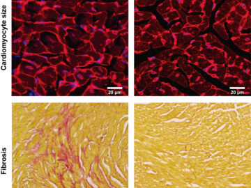 Nature Cardiovascular Research: Researchers uncover a new mechanism underlying the most common inherited heart disease and confirm the effectiveness of a next-generation therapy