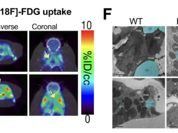 International study identifies a key mechanism regulating how cells use fat to generate energy